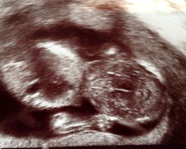Jetzt kann ich es ja sagen – ich bin schwanger! Von Fehlgeburten und den ersten 12 Wochen.