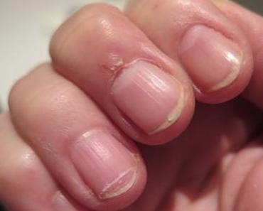 Mein Nagel Experiment