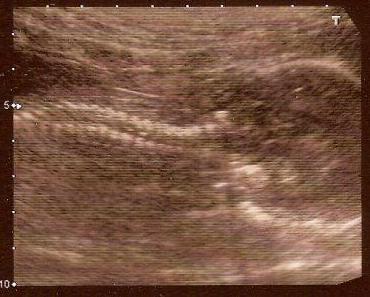 [Favola privat] meist erwarteter Neuzugang 2012