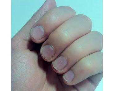 [Nails] Vorher- Nacher *Nagelmoellage*