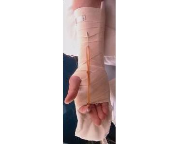 75 – Spickzettel Unfallchirurgie