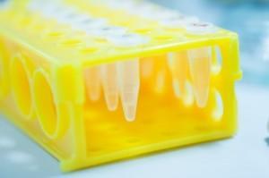 Testosterontest Blut- oder Speicheltest ?